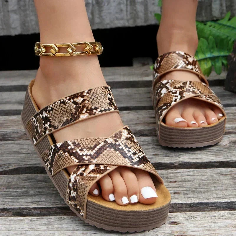 Naya™ | Sandalias Ortopédicas - Comodidad inigualable para tus pies